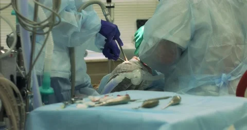 Surgical operation to remove a tooth under anesthesia Stock Footage 166203816