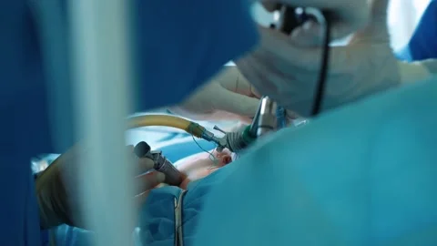 Surgical operation of the stomach. Operating room, surgeons perform an operation Stock Footage 228884111