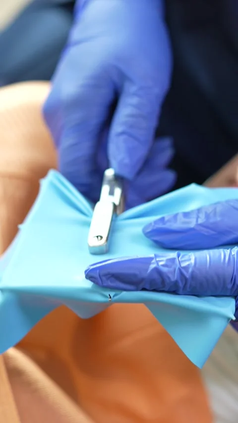 Surgical Preparation Video stock 316914571