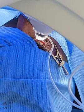 Surgical procedure on exposed wound using clamp and tubing in operating room Stock Photos
