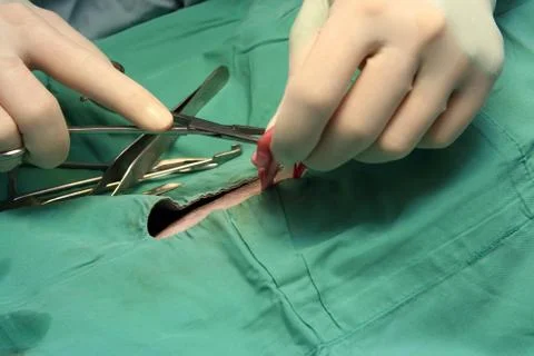 Surgical procedure Stock Photos