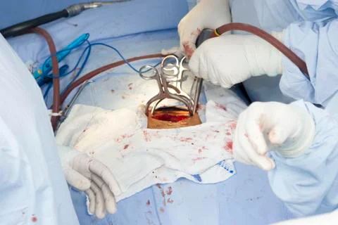Surgical procedure Stock Photos