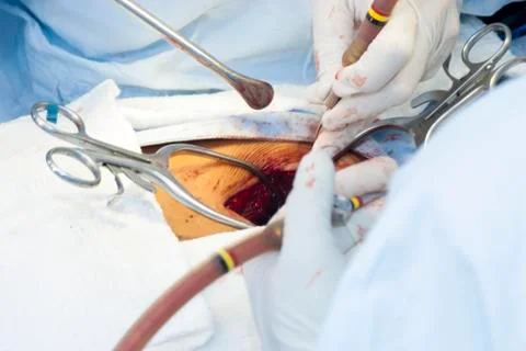Surgical procedure Stock Photos