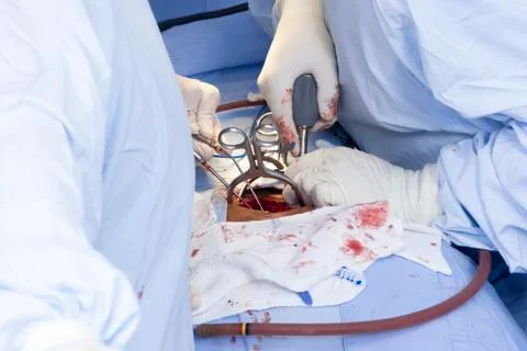 Surgical procedure Stock Photos