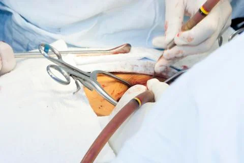 Surgical procedure Stock Photos