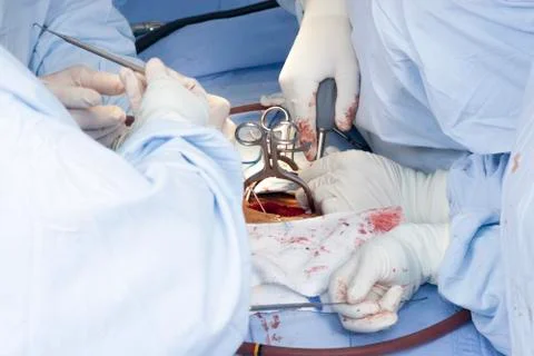 Surgical procedure Stock Photos