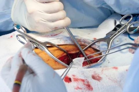 Surgical procedure Stock Photos