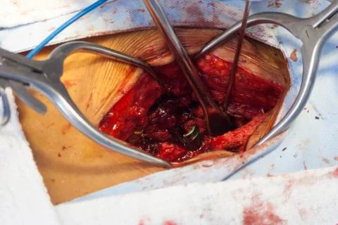 Surgical procedure Stock Photos