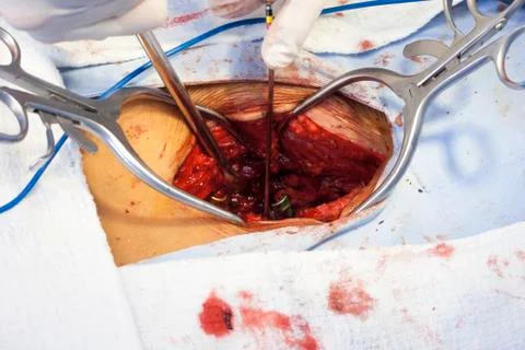Surgical procedure Stock Photos