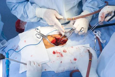 Surgical procedure Stock Photos