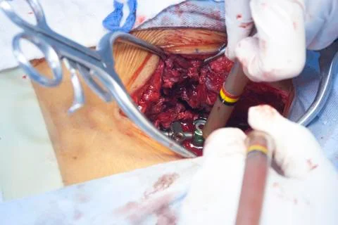 Surgical procedure Stock Photos