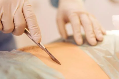 A surgical procedure Stock Photos