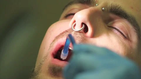 Surgical protocol of dental implants Stock Footage 44907680