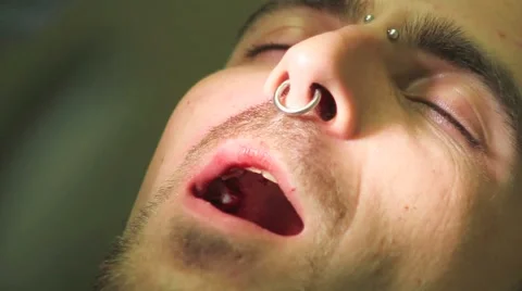 Surgical protocol of dental implants Stock Footage 44907736