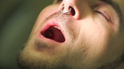 Surgical protocol of dental implants Stock Footage 44907788