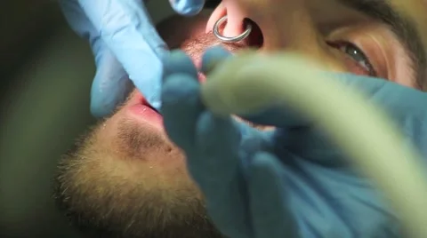 Surgical protocol of dental implants Stock Footage 44907866