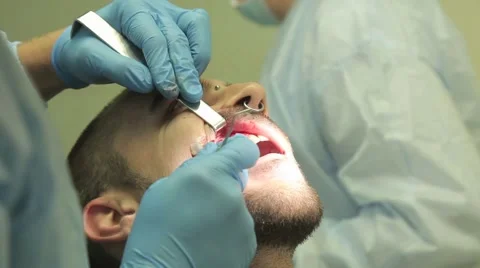 Surgical protocol of dental implants Stock Footage 44908079