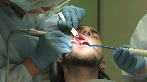 Surgical protocol of dental implants Stock Footage 44908121