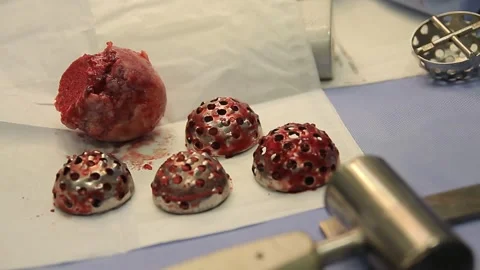 Surgical Reamers Close-up Stock Footage 288811427