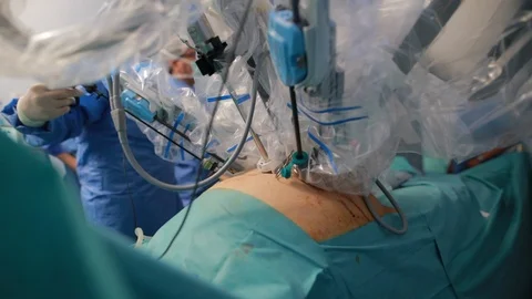 Surgical robot with laparoscopy camera and intervention arms for robotic surg 動画素材 102221607