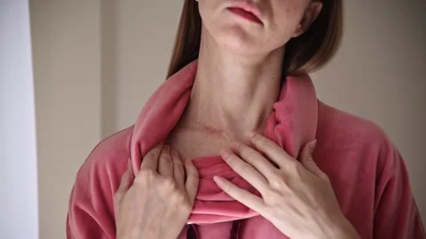 Surgical scar on neck. Stock Footage 142742039