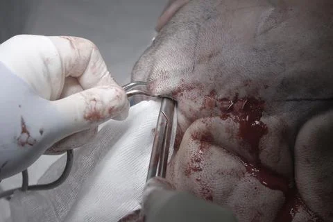 Surgical Scissors In a Head Stockfoto's