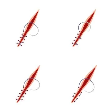 Surgical sutures closing a wound using medical stitches Stock Illustration