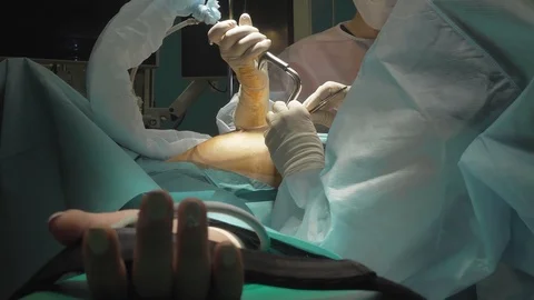 Surgical team are performing surgery on breasts in hospital operating room. Видео 89955108