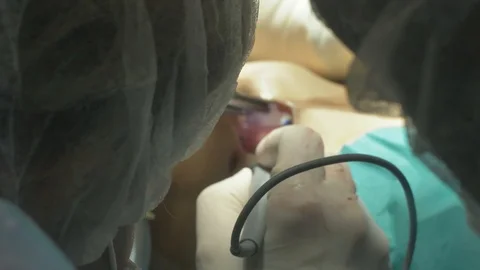 Surgical team are performing surgery on breasts in hospital operating room. Видео 89955126