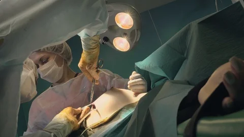 Surgical team are performing surgery on breasts in hospital operating room. Видео 89955289