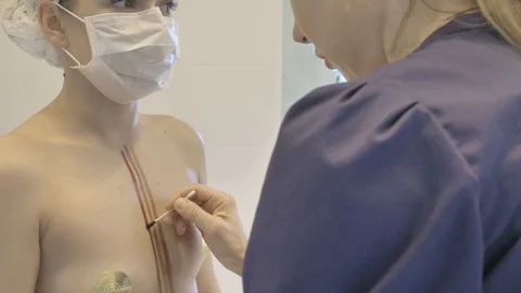 Surgical team are performing surgery on breasts in hospital operating room. Видео 89955338