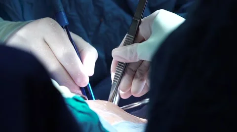 Surgical teamwork,surgeon's hands Stock Footage 65019077