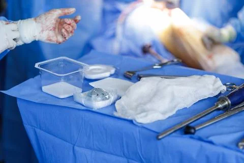 Surgical Tools and Endoprosthesis in Operating Room for Hip Replacement Stock Photos