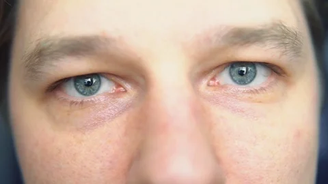 Surprise, eyes close-up Stock Footage 84568560