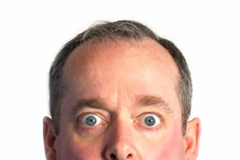 Surprised Stock Photos