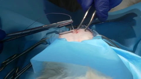 Suture Stock Footage 120943838