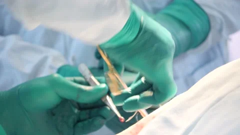 Suturing after surgery Stock Footage 139064503
