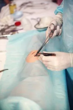 Suturing wounds close up Stock Photos