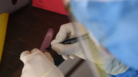 Swab sample Stock Footage 131171815