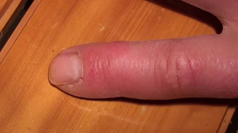 Swallen first finger Stock Footage 47811024