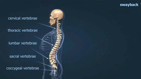 Swayback condition of the spine Stock Footage 288180093