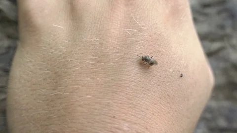 SWEAT BEE ON HAND SUMMERTIME ALLERGIES Stock Footage 84227190
