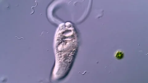 Swimming Fluke Larvae Captured under Microscope Vídeos de archivo 317223500