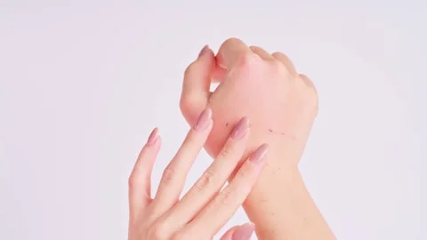 Swollen female hand with cat bite marks and scratches Vidéo 347121760