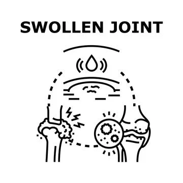 Swollen joint condition causing pain and inflammation イラスト素材