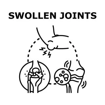 Swollen joints causing pain and inflammation concept イラスト素材