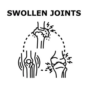 Swollen joints disease concept vector illustration Illustrazione stock