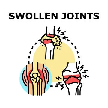 Swollen joints disease concept vector illustration Illustrazione stock