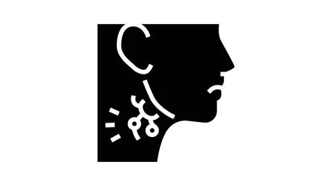 Swollen lymph glands hiv symptom glyph icon animation Stock Footage 224824595