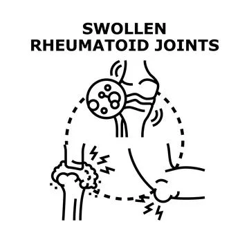 Swollen rheumatoid joints causing pain and inflammation イラスト素材